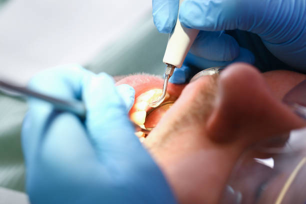 Best Tooth Infection Emergency Dentist  in Claremont, NH